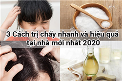 3 Cách trị chấy nhanh và hiệu quả tại nhà mới nhất 2023