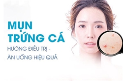 Chuyên gia trả lời câu hỏi: Làm gì để hết mụn trứng cá hoàn toàn